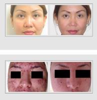 Laser Skin Care Center image 1